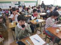 まずは歯肉のチェック